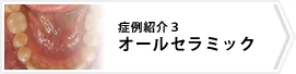 症例3 オールセラミックス