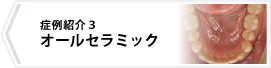 症例3 オールセラミックス