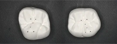 機能的な咬み合わせの維持