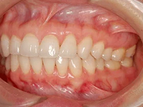 治療例のイメージ