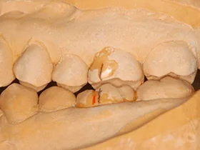治療例のイメージ