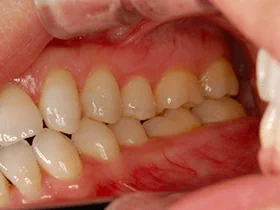 治療例のイメージ