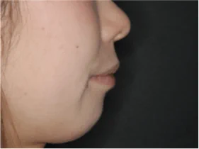 エステティックライン