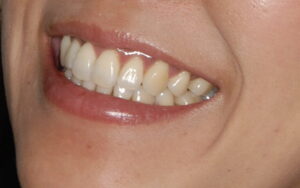 福岡天神｜渡辺通さとう歯科・矯正歯科｜今日生後の素敵な笑顔